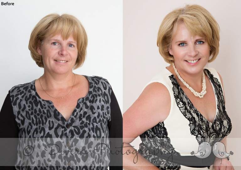 Zoe before and after